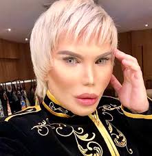 And in order to make good use of the excess, he has had the leftover fat inserted into his backside, giving him a fuller derrière. Rodrigo Alves Ladies And Gents He S Been On Here Before But He S Ever Changing In His Pursuit Of Perfection Really Fucking Sad Botchedsurgeries