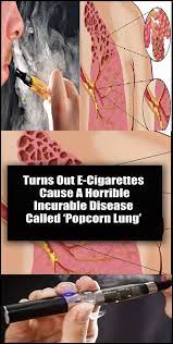 Pin On Healthy Living