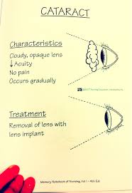 Pin On Cataracts