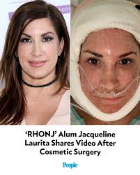 Jacqueline Laurita is giving a glimpse of her latest cosmetic surgery,  showing fans how she looks immediately after a facelift and neck lift. Tap  the link in bio for the full story.