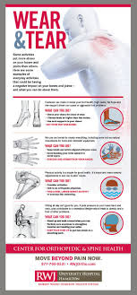Rwj Infographic Orthopedic Bone And Joint Foot Health Everyday Activities