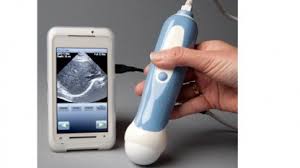 Portabel Smartphone Als Ultraschallgerat Golem De