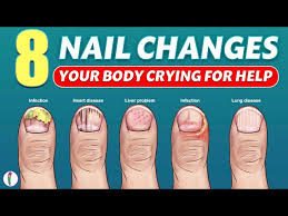 Image result for Pitting nails feet