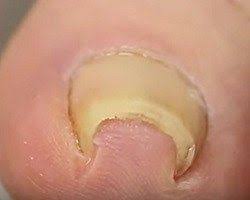Curso Curso Remedios Caseros