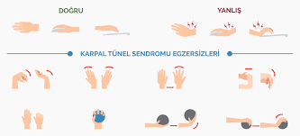 Sinir Sikismasi Karpal Tunel Ameliyati Ozel Meltem Hastanesi