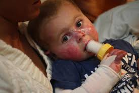 Mason is in constant pain from rare genetic condition