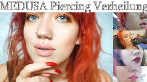 This is the newest trend of lip piercing that is becoming increasingly popular among the youngsters out there. Medusa Piercing Der Heilungsprozess Youtube