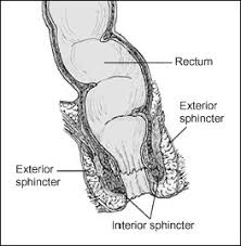 Image result for Fecal Incontinence