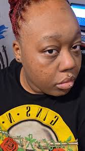 What are tips and tricks for getting rid of dark circles?