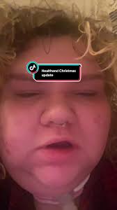 Cold Health Alert for Uk Christmas Day