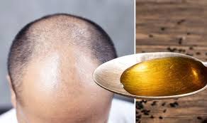 Often, the dermatologist will try to find the cause of the hair loss in black men and will recommend the hair loss treatment that will best fix this issue. Hair Loss Treatment Try Black Cumin Oil Express Co Uk