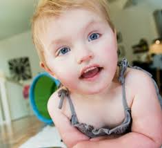 Ingen vet om Ada (2) vil lære å gå eller snakke