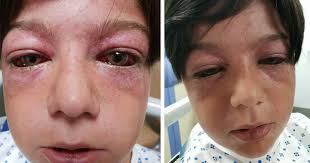 Nouveau Jeu De La Cour De Recre Fait Qu Un Garcon De 11 Ans A Un Air D Alien La Mere Veut Alerter Tous Les Parents