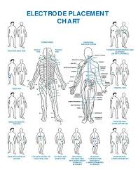 Tens Unit Placement Chart Google Search Tens Unit