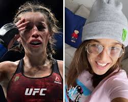 Rose namajunas vs joanna jędrzejczyk 1! Ufc News Joanna Jedrzejczyk S Face Healing Up Nicely After Ufc 248 War Against Weili Zhang Mma India
