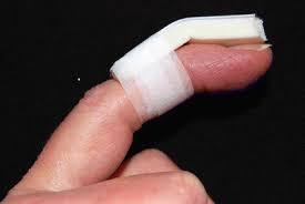 Image result for DIP Dislocation