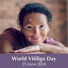 Today is World Vitiligo Day. A day we celebrate people with vitiligo and  discuss the challenges they face. Our patient support group  @vitiligo_association_australia held an online event over the weekend with  ACD
