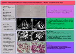 Diagnostic and therapeutic challenges in rapidly progressing cardiac  amyloidosis: a literature review based