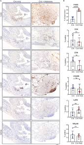 Check spelling or type a new query. Asbestos Accelerates Disease Onset In A Genetic Model Of Malignant Pleural Mesothelioma Biorxiv