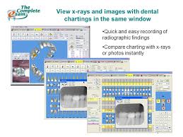 Total Dental Software All Inclusive Patient Charting And