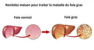 Pin On Soigner Le Foie Gras