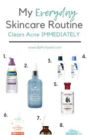 Acne Face Mapping Body Acne Face Mapping Boys Acne Face Mapping Break Outs Acne Face Mapping Chinese Everyday Skin Care Routine Everyday Skincare Skin Care