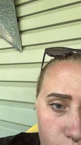 What facial SPF and nighttime moisturizer are recommended for dry and  acne-prone skin?