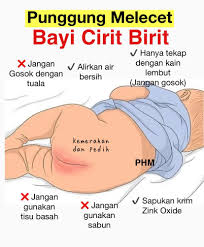 Sup kosong dan minuman manis juga membantu anak mendapat cecair dan penambahan kalori dalam tubuh. Public Health Malaysia Jika Bayi Alami Cirit Birit Mereka Akan Menangis Kesakitan Apabila Punggung Dibersihkan Sebenarnya Mereka Menangis Bukan Kerana Cirit Birit Tetapi Akibat Punggung Yang Melecet Perhatikan Permukaan Kulit Yang
