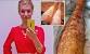 Red Welts After Laser Hair Removal