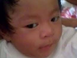 Fundraiser for Maggie Wasserman by Fely Peralta : Help fund a operation for  Nigel