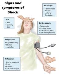 Can you easily spot and recognized a patient with shock? - joe🚑