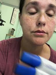 Fertility Journey: Embracing Hope Beyond Infertility