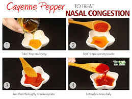 Home Remedies For Nasal Congestion Nasal Congestion Chest Congestion Cold Remedies