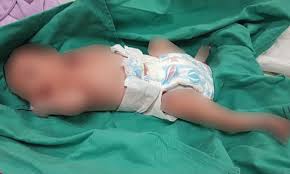 Kes pembuangan bayi akan memberikan kesan kepada bayi tersebut.sebagai contoh,bayi yang dilahirkan oleh remaja yang terlibat sama ada cukup bulan atau tidak,akan terbiar dan natijahmya terpaksa dibuang bagi data kes pembuangan bayi. Malaysiakini Jumlah Kes Buang Bayi Paling Tinggi Di Johor