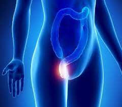 Todo Lo Que Tienes Que Saber Sobre Hemorroides Tu Canal De Salud
