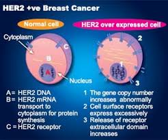 May 24, 2021 · how does herceptin work? Breast Cancer Hong Kong Breast Cancer Foundation Targeted Therapy