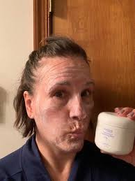 I have dermatillomania (skin picking), with the majority of it