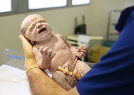 When a baby is in the womb, a thick waxy coating called vernix caseosa, or vernix, develops on the baths can have an adverse effect on a baby's skin. Newborn Care Things You Need To Know About Vernix Kingdom Of Baby