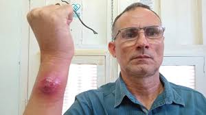 Un preso político del 11J padece una crítica condición psiquiátrica y no  recibe atención médica especializada