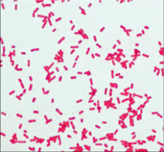 A salmonella sample can be obtained directly from the patient (feces) or from contaminated water/foods. S Enterica Gram Stain