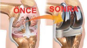 sabahlari parmak bilek kol ya da bacak eklemlerinizde siddetli agrilar ile uyaniyorsaniz romatoid artrit ra nutella bottle natural magic nutribullet blender