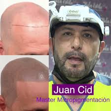 ¿Te preocupa la caída del cabello? , Te sientes cada vez más espacios ,  Tenemos una solución que te dará el efecto de densidad capilar, sin  contraponer al crecimiento del cabello y con efecto ...