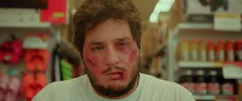 Le doigt dans l'oeil