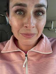 Before and After of AshLin Esthetics, LLC working her magic