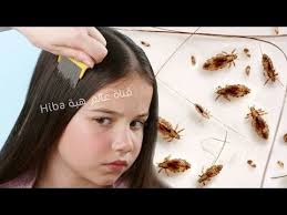 Youtube Health And Beauty Lice Removal Head Louse