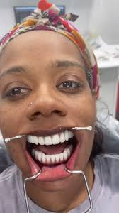 Changing Lives and Yours Could Be Next 🤩 #allonxdentalimplants #allon...