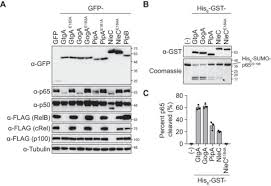 Francis pereira partner at francis pereira & shan kuala lumpur, wilayah persekutuan kuala lumpur, malaysia 101 kenalan Structure Function Analyses Of The Bacterial Zinc Metalloprotease Effector Protein Gtga Uncover Key Residues Required For Deactivating Nf Kb Journal Of Biological Chemistry