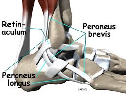 Stretching this ligament keeps the patella in place and the ligament healthy.stretching a lateral retinaculum of the knee. Peroneal Tendon Subluxation Eorthopod Com