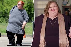 1000Lb Sisters Before And After Weight Loss.. *Tammy & Amy Slaton* - Youtube