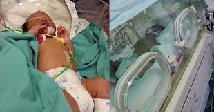 Tanda bayi sukar bernafas perut berombak perlu rawatan segera. Kuman Merebak Ke Paru Paru Hampir Masuk Ke Otak Akibat Kesilapan Ibu Uwais Koma 3 Hari Pa Ma